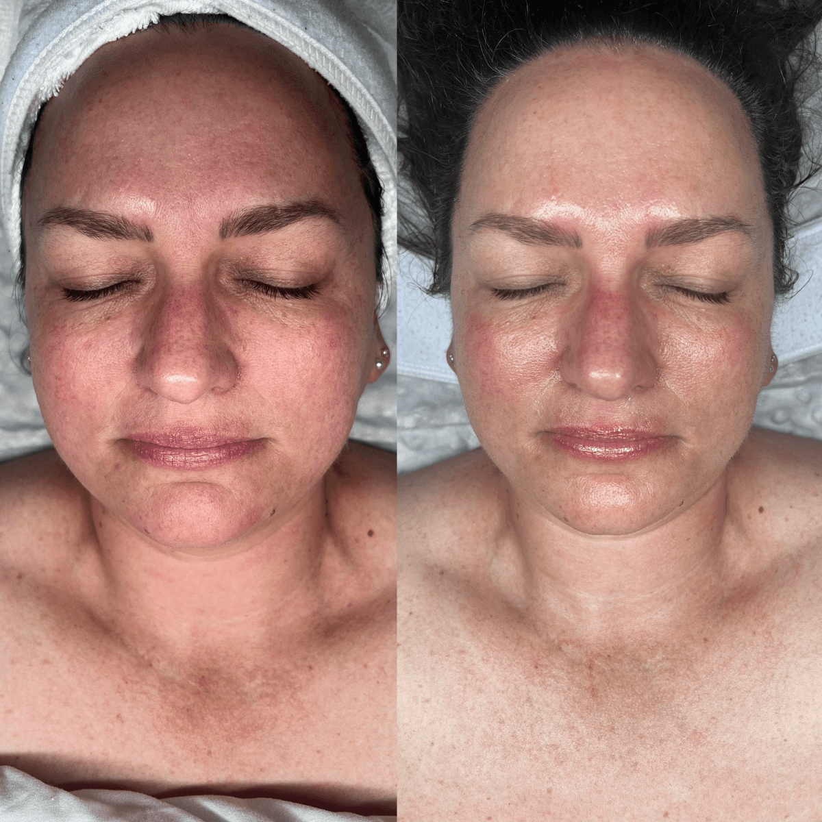 Before and After