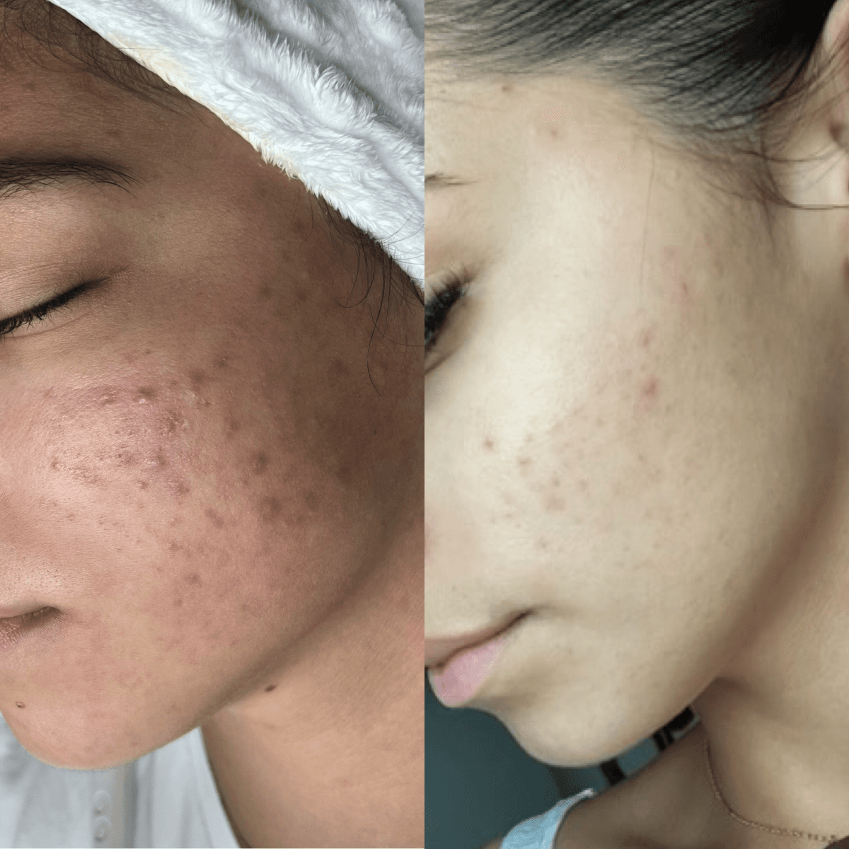 Before and After