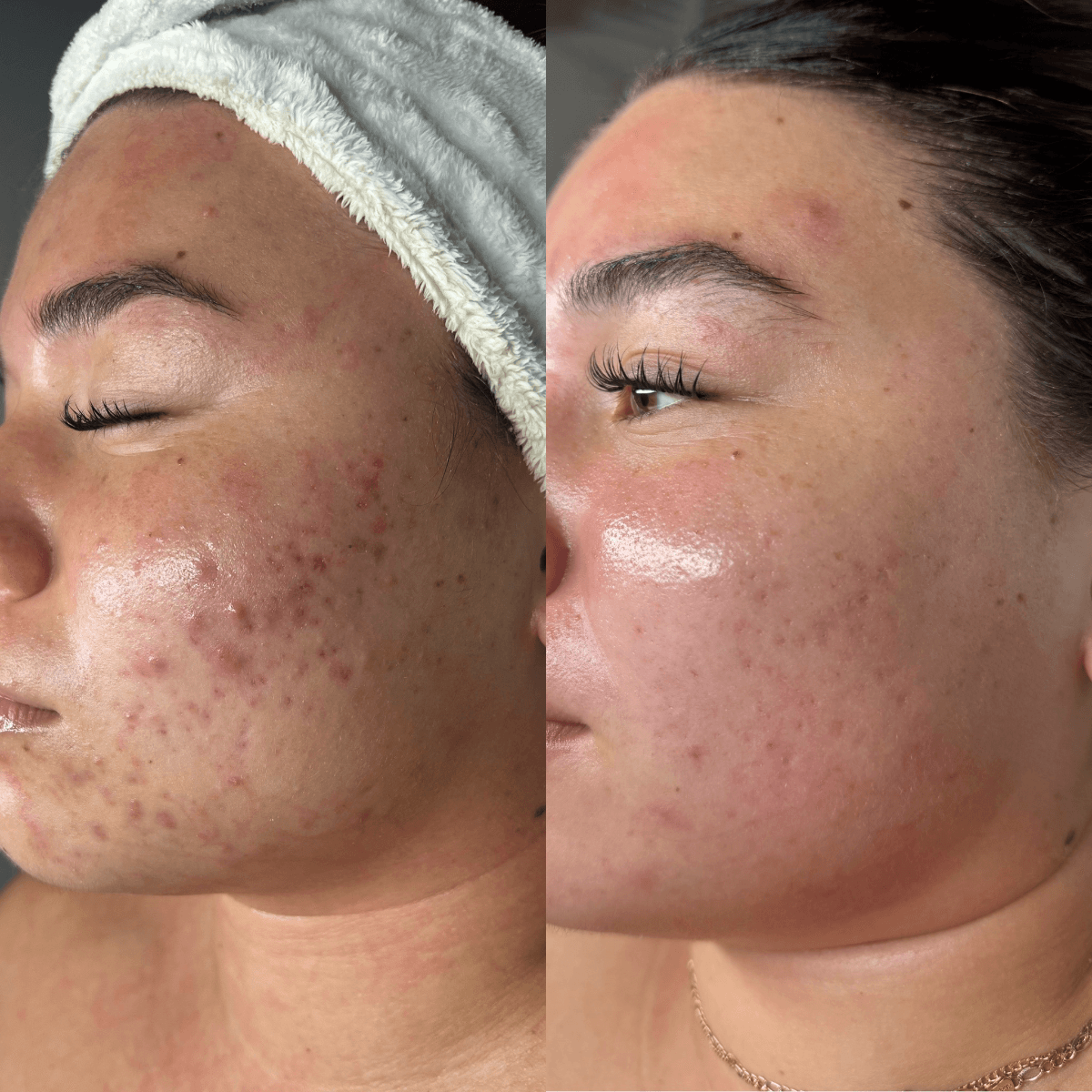Before and After